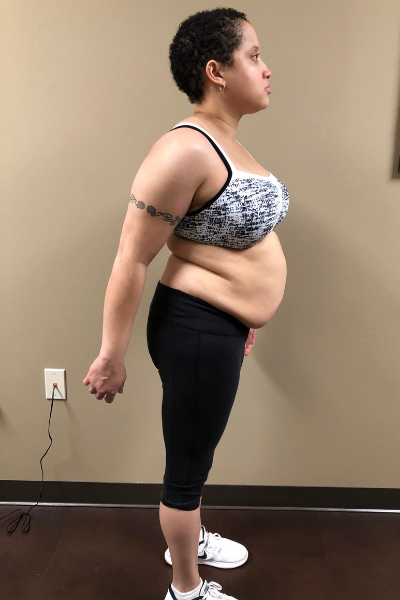 Client 1 Transformation - Before Side